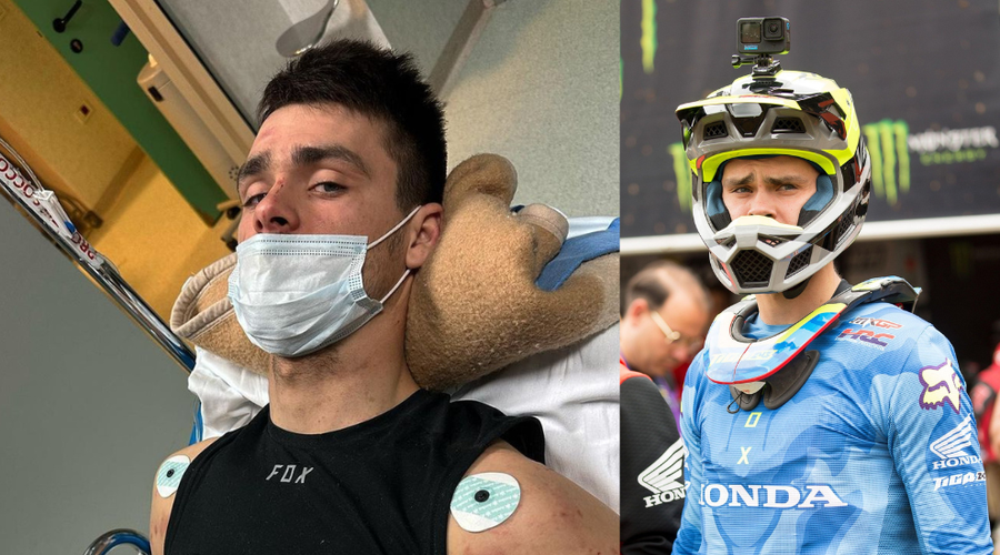 Tim Gajser je moral po zlomu stegnenice pod nož: vemo, ali je bila operacija uspešna (foto: Profimedia/Instagram/Tim Gajser/fotomontaža)
