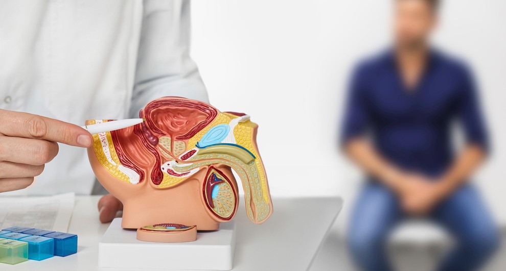 RAK PROSTATE Moški, ki se dalj časa vzdržujejo spolnosti, bi lahko bili po nekaterih raziskavah izpostavljeni večjemu tveganju za raka …