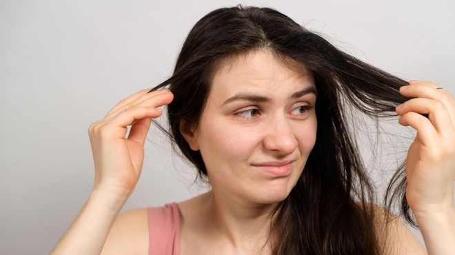 Vaši lasje so mastni že po enem dnevu: poskusite težavo rešiti s tem trikom (VIDEO) (foto: Profimedia)