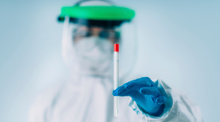 Tri leta od začetka pandemije koronavirusa: sprva je bil kriv luskavec, nato netopir, zdaj ... je verjetno, da je virus zares izšel iz laboratorija? (foto: Profimedia)