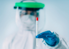 Tri leta od začetka pandemije koronavirusa: sprva je bil kriv luskavec, nato netopir, zdaj ... je verjetno, da je virus zares izšel iz laboratorija?