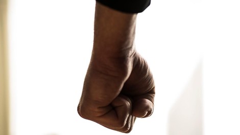 Dva Roma brutalno pretepla dijaka prvega letnika: zbila naj bi mu vsaj en zob, končal je na urgenci