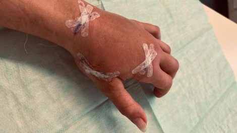 Brez diagnoze, a v hudih bolečinah: zdaj je znana Slovenka morala pod nož