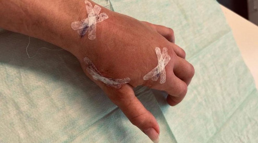Brez diagnoze, a v hudih bolečinah: zdaj je znana Slovenka morala pod nož (foto: Osebni arhiv Nine Grilc)