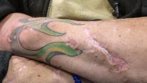 "Dobesedno poje tvoje telo" – nova 'zombi droga' straši po Ameriki, obstaja nevarnost, da se bo razširila v Evropo (FOTO in VIDEO)