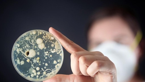 Skrb vzbujajoče: to je predmet, na katerem je več mikrobov kot na straniščni školjki