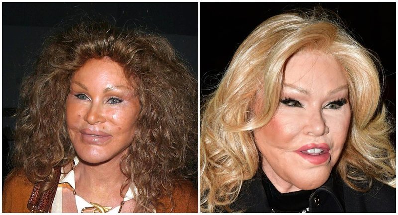 Jocelyn Wildenstein leta 2003 in danes.