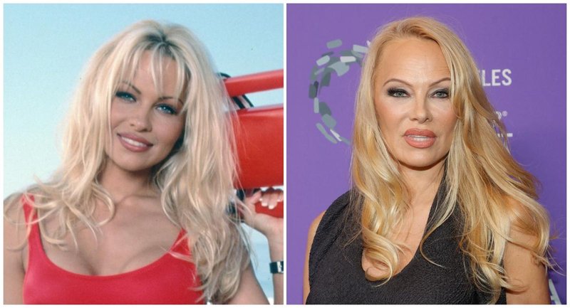 Pamela Anderson leta 1995 in danes.