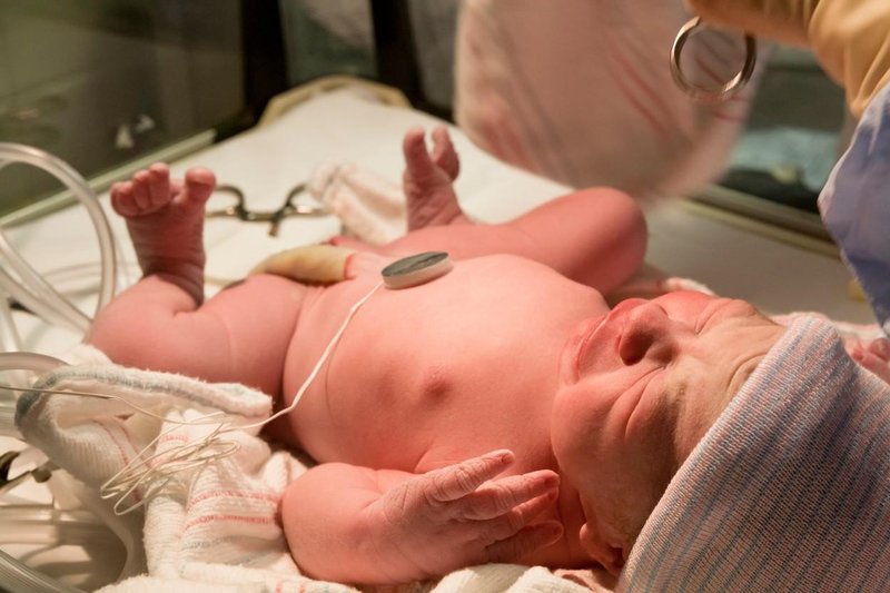 Ker je bil rojen prezgodaj, so ga dali v inkubator. (Fotografija je simbolična.)