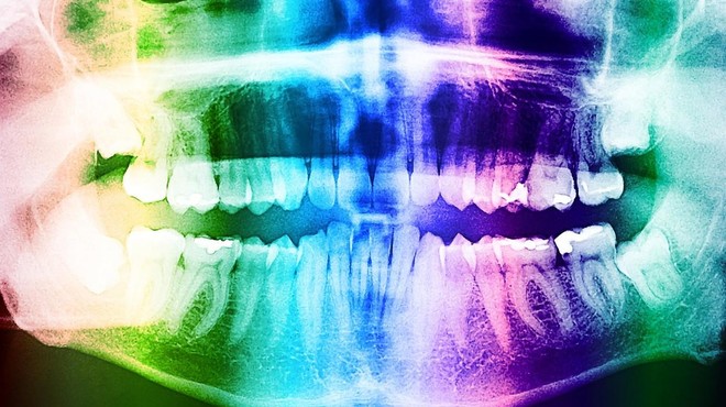 Leta 2030 bodo (s pomočjo zdravila) ljudem zrasli novi, tretji zobje, trdijo japonski znanstveniki (foto: profimedia)