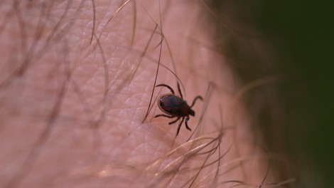 Po ugrizu klopa se pri ljudeh pojavlja vse več zelo nenavadnih alergij (prepoznajte znake)