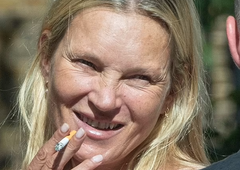 Šok nad videzom slavne manekenke: "Krivo je njeno burno življenje"