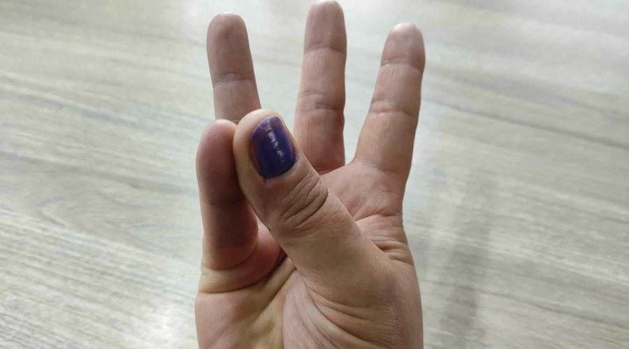 S palcem se dotaknite mezinca in preverite, ali ste posebni (foto: Uredništvo)