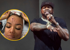 Slavni raper obiskovalki koncerta povzročil poškodbe po obrazu (zdaj pa jo bo odnesel brez posledic)