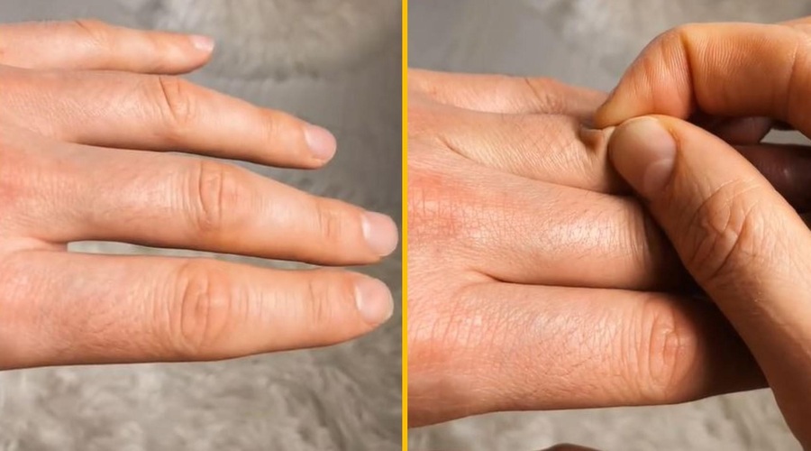 3-sekundni test, ki razkrije, ali ste dehidrirani, so nam kazale že babice, zdaj pa je postal viralna senzacija (VIDEO) (foto: TikTok/Remus Bujor/posnetek zaslona)