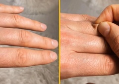 3-sekundni test, ki razkrije, ali ste dehidrirani, so nam kazale že babice, zdaj pa je postal viralna senzacija (VIDEO)