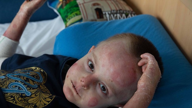 Štiriletni Miloš s hudo redko boleznijo bo prejel revolucionarno zdravilo: "To je resnično grozljiva bolezen, ki zahteva 24-urno nego" (foto: Društvo Viljem Julijan)