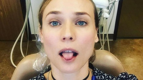 Ženska dela selfie na pregledu pri zobozdravniku