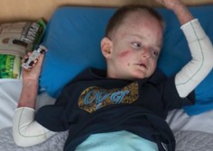 Slovenci smo stopili skupaj in rešili življenje: 4-letni deček Miloš s kruto boleznijo je prejel prvi odmerek zdravila (FOTO in VIDEO)
