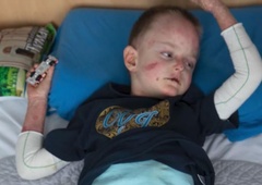 Slovenci smo stopili skupaj in rešili življenje: 4-letni deček Miloš s kruto boleznijo je prejel prvi odmerek zdravila (FOTO in VIDEO)