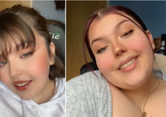 Ko se "zdravstveni turizem" spremeni v nočno moro: 20-letnica umrla po lepotni operaciji v Turčiji (in ni edina)