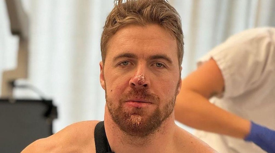 Se bo Kilde po hudem padcu sploh vrnil na bele strmine? Prihodnost je negotova ... (foto: Instagram/akilde)