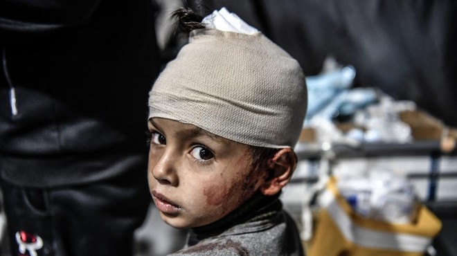 ZN: "V Gazi je stopnja podhranjenosti otrok najhujša na svetu" (foto: Profimedia)