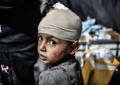 ZN: "V Gazi je stopnja podhranjenosti otrok najhujša na svetu"
