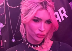 Ena najlepših igralk zaskrbljujoče spremenjena: "Njenega kirurga bi morali tožiti"