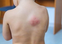 Pozor, če potujete v našo sosednjo državo! Dvignili so stopnjo pripravljenosti zaradi nevarnega virusa