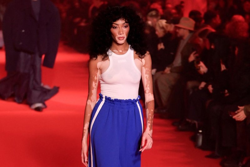 Winnie Harlow