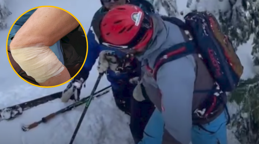 Grozljivka na priljubljenem smučišču: medved napadel smučarja in ga ugriznil v nogo (VIDEO) (foto: posnetek zaslona/YouTube)