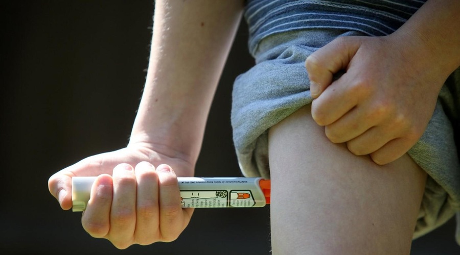 Nove ugotovitve: če imate takšne alergijske reakcije, imate najverjetneje gensko bolezen (foto: Profimedia)