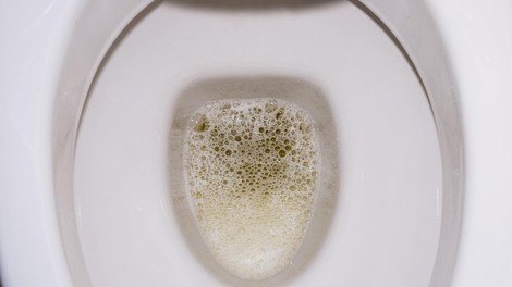 Wc skoljka - penast urin