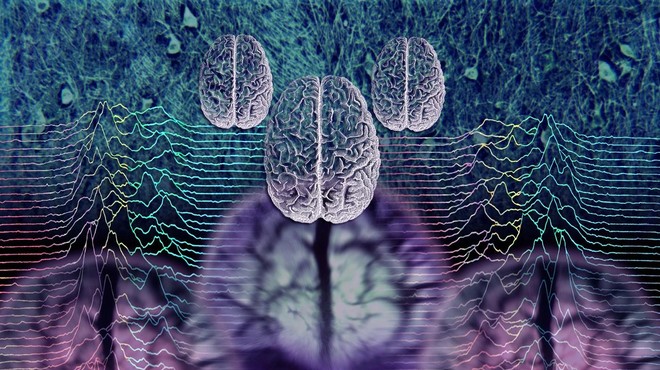 Nova študija razkriva, kateri deli možganov delujejo drugače pri ljudeh s psihozo (foto: profimedia)