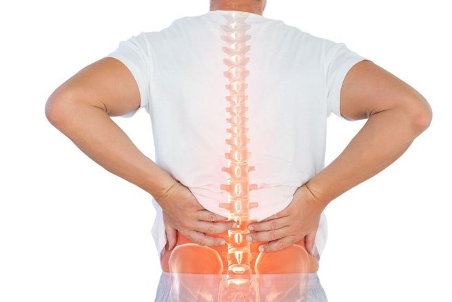 Hernija diska: Rehabilitacija ali operacija?