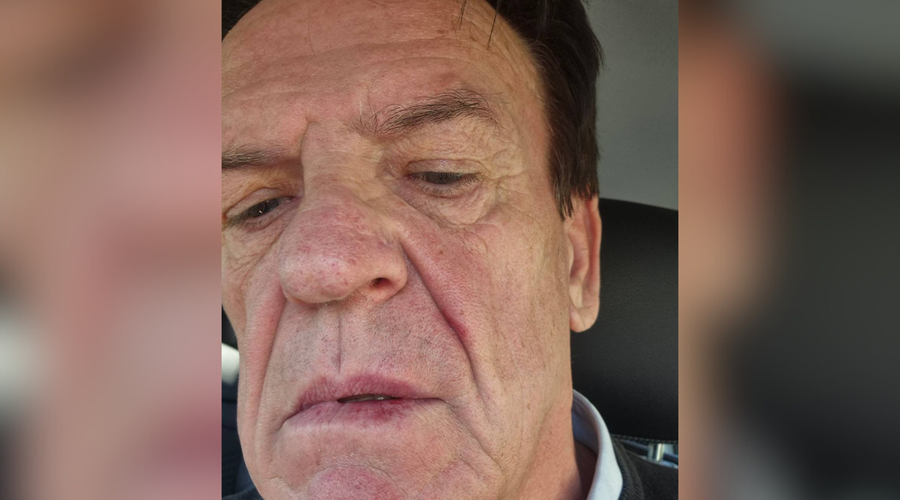 Prvi obraz upokojenskih protestov Pavel Rupar na urgenci: s pestjo naj bi ga udaril njegov nekdanji strankarski kolega (foto: X/Glas upokojencev)