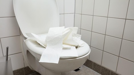 WC stranišče školjka umazanija čiščenje