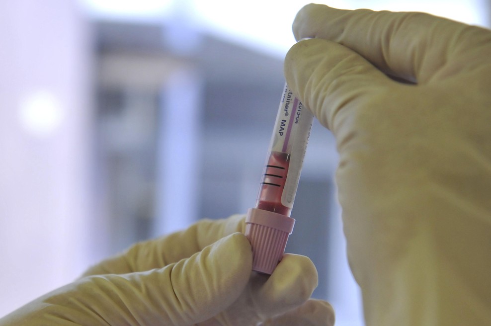 Po šokantnem dogodku v laboratoriju ljubljanskega UKC: kje bodo zdaj izvajali laboratorijske analize? (foto: Žiga Živulović jr./Bobo)