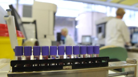 UKC, laboratorij