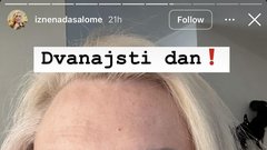 Salome lepotni poseg operacija kirurg
