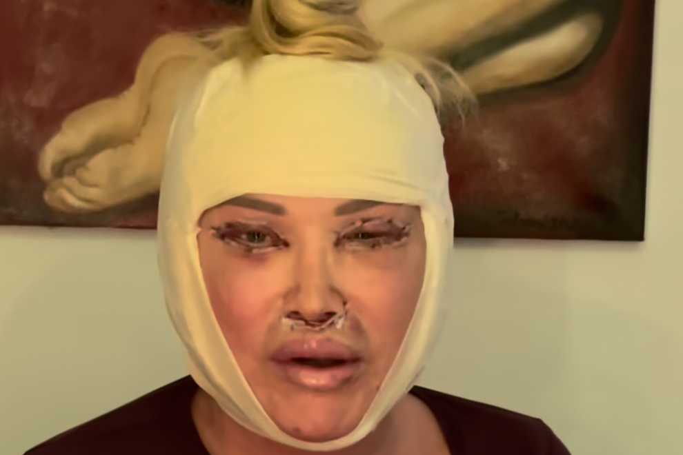 salome lepotna operacija lepotni poseg