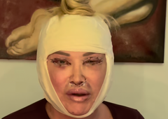 Objava, ki je marsikomu vzela sapo: znana Slovenka razkrila osupljive podrobnosti operacije obraza (FOTO in VIDEO)