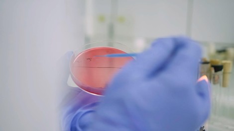 ebola