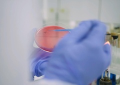 Smrtonosni virus spet udaril z vso silo - oblasti nemočne pred redkim sevom, zanj ni zdravila!