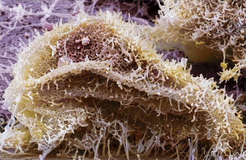 ebola
