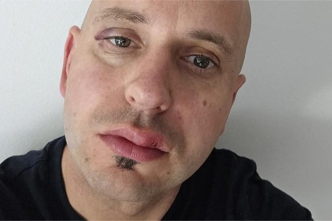 Začelo se je sojenje dvojici Romov, ki sta pretepla ribniškega župana: znane so nekatere podrobnosti