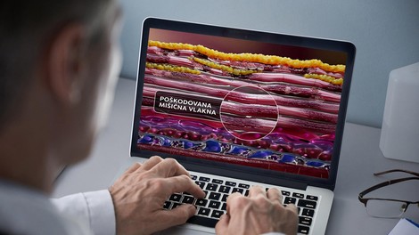 EU je odobrila novo zdravilo za zdravljenje Duchennove mišične distrofije