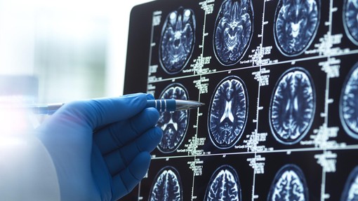 Nevrolog: "Za ohranjanje zdravih možganov in ostrega spomina se izogibam 4 navadam, ki jih ljudje počnejo vsak dan"