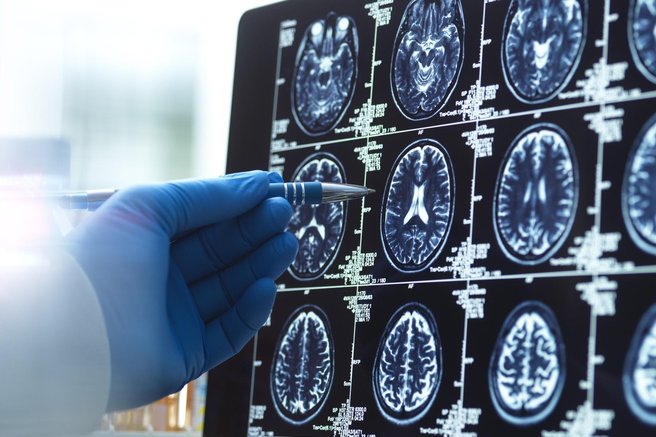 Nevrolog: "Za ohranjanje zdravih možganov in ostrega spomina se izogibam 4 navadam, ki jih ljudje počnejo vsak dan"